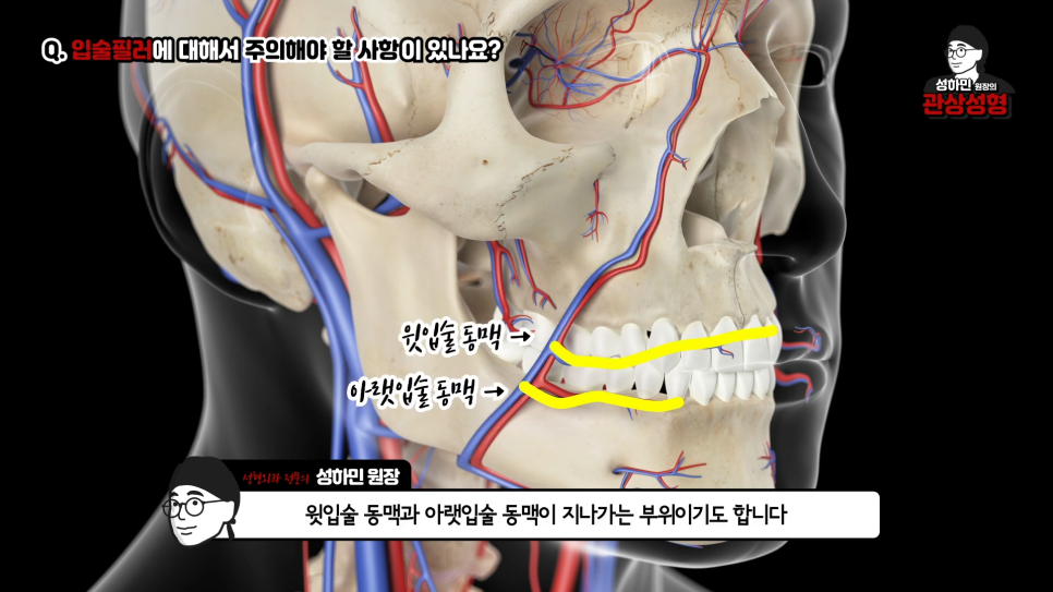 [봉봉성형외과] 입술필러 시 나타날 수 있는 부작용은 무엇? 관련 이미지 4