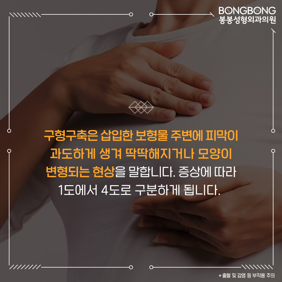 가슴재수술 더 이상 실패 안하려면 이것만 명심하세요 관련 이미지 6