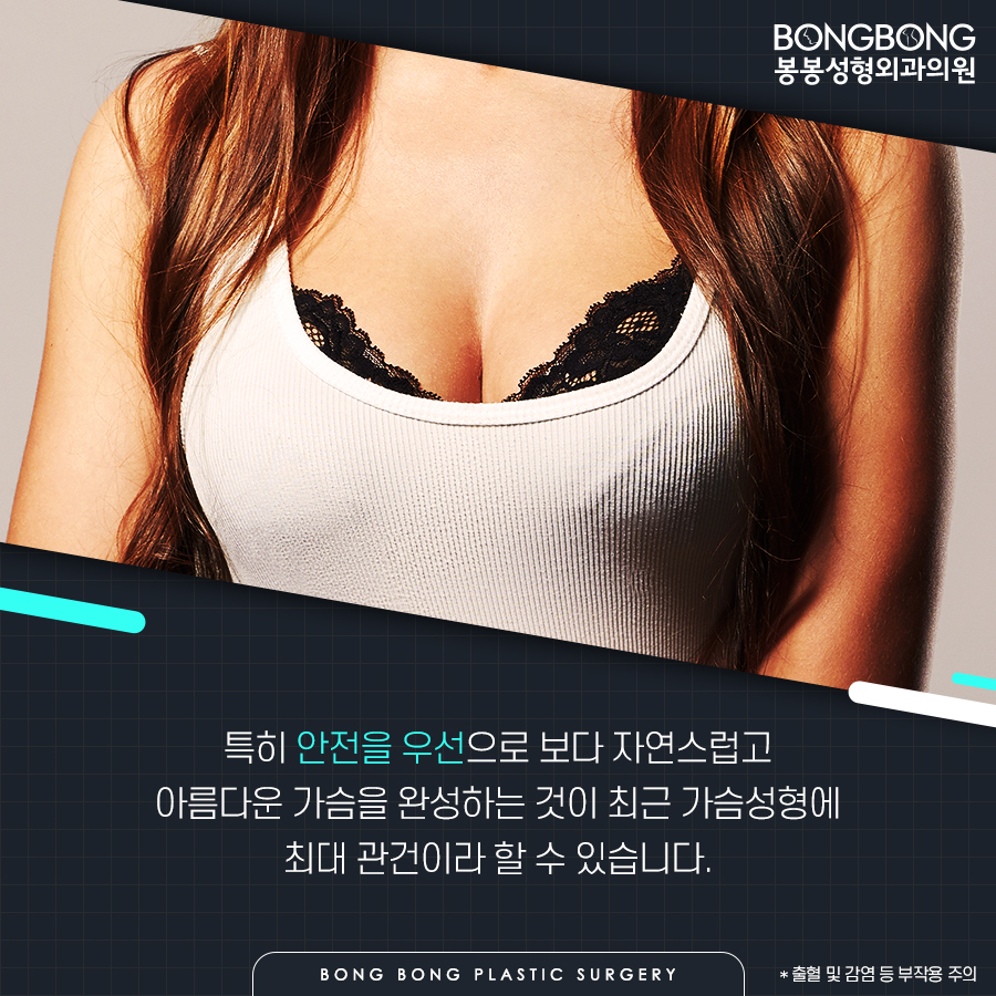 자연스러운 가슴성형, 봉봉성형외과의 벨라젤 마이크로 관련 이미지 11