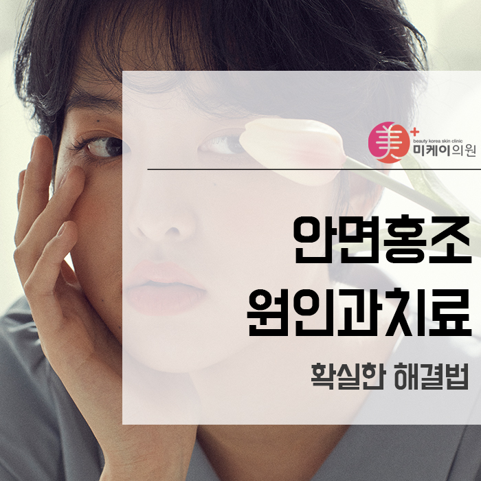 안면홍조원인과치료 확실한 해결법 관련 이미지 1
