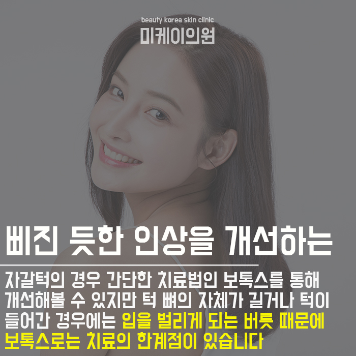 강남 자갈턱보톡스 자연스러운 변화 관련 이미지 4