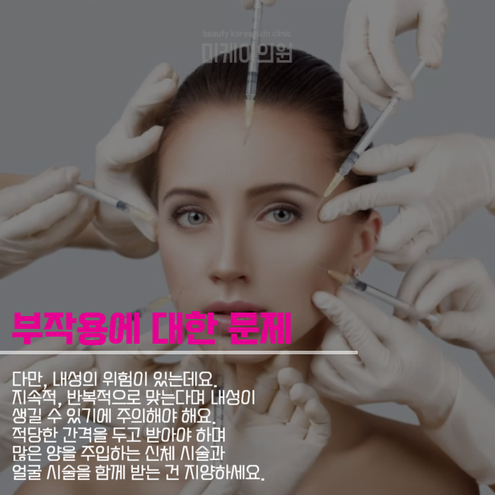필러와보톡스차이 알아야 받을 수 있죠 관련 이미지 5