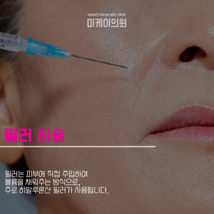 팔자주름 시술 종류 효과적인 개선 방법 관련 이미지 3