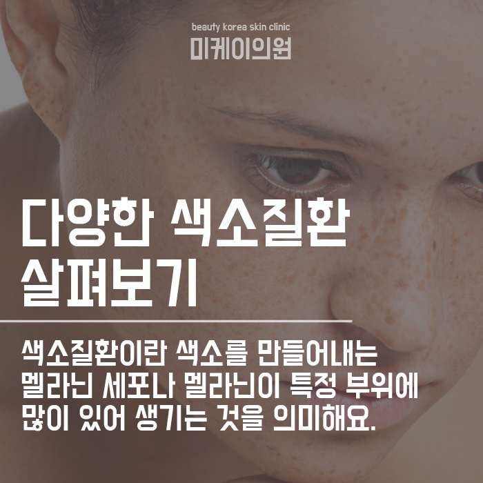 서초기미제거로 맑은피부톤 만들기 관련 이미지 2