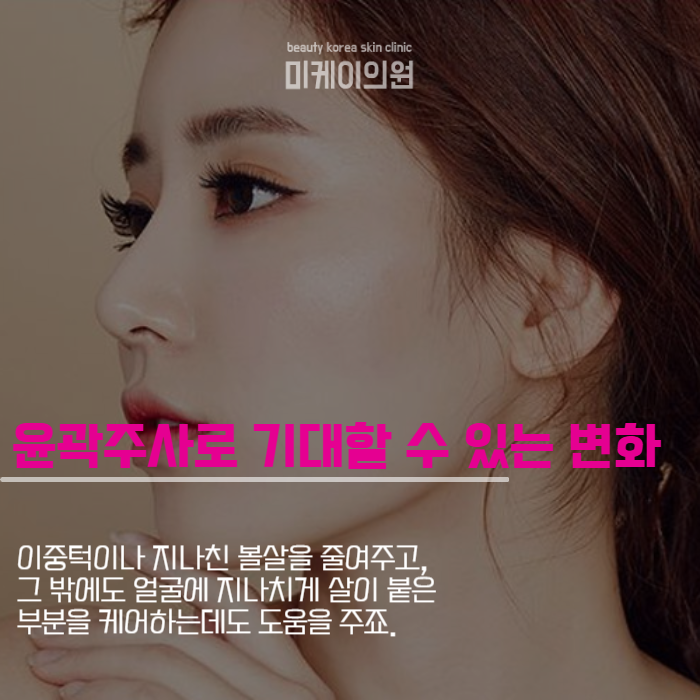강남역윤곽주사 수술 걱정 없이 턱선 다듬기 관련 이미지 3