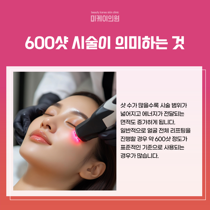 Gangnam Oligio 600-Shot Price: Choosing a Reasonable Amount image 3