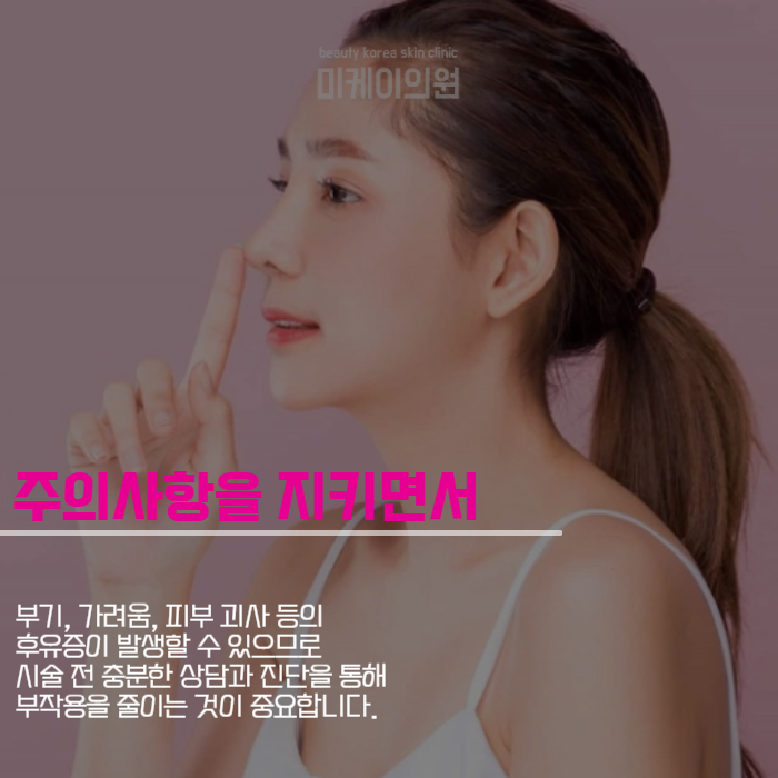 콧볼줄이는방법 자연스럽게 할 수 있어요 관련 이미지 5
