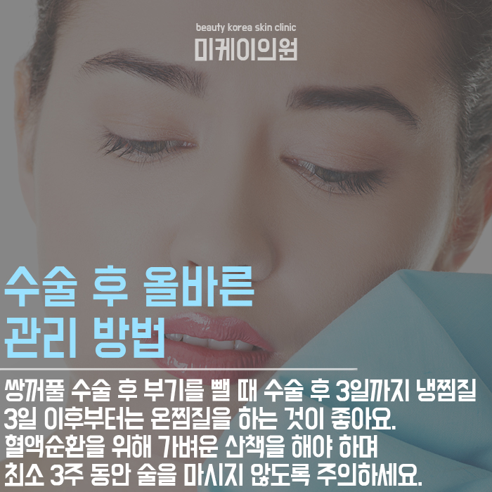 쌍꺼풀수술후관리 이것만큼은 꼭 기억하자! 관련 이미지 5