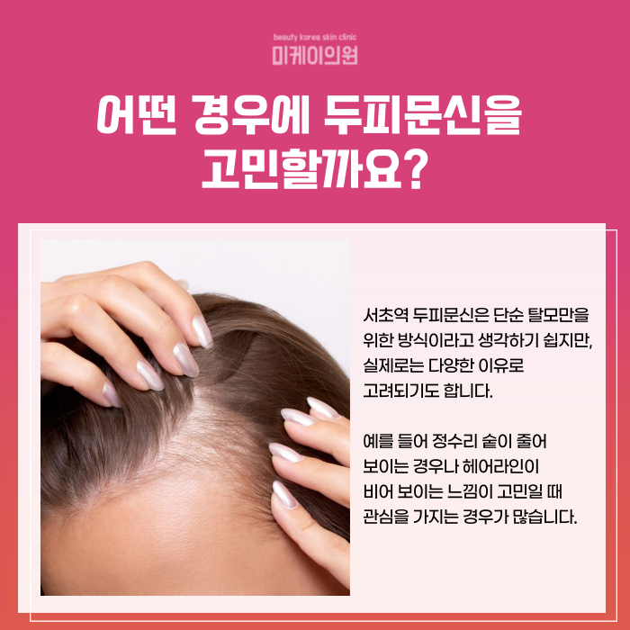 Sopoong Station Scalp Micropigmentation for a Natural-Looking Cover image 2