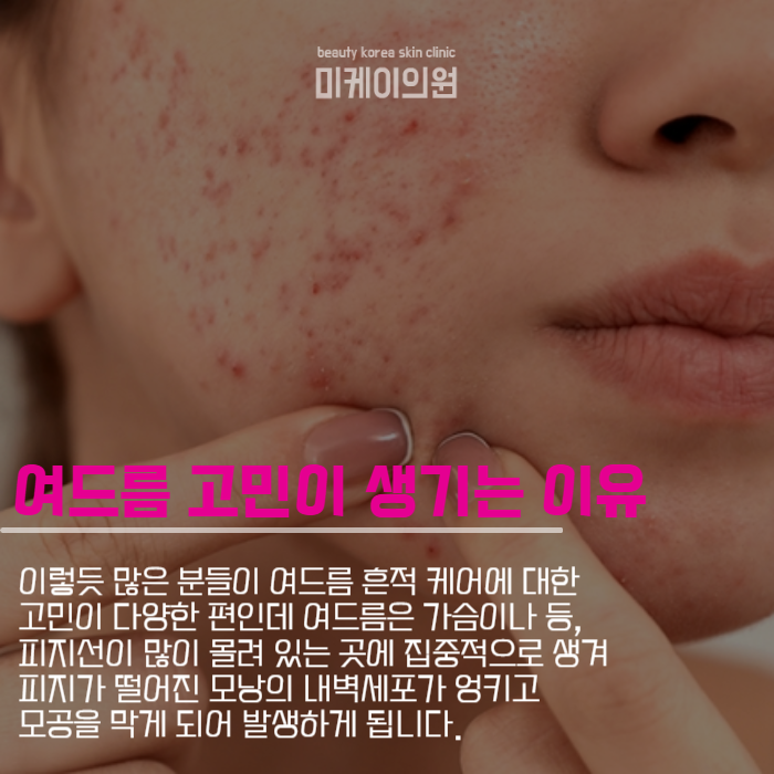 강남역 프락셀 여드름 흉터 걱정된다면 관련 이미지 2