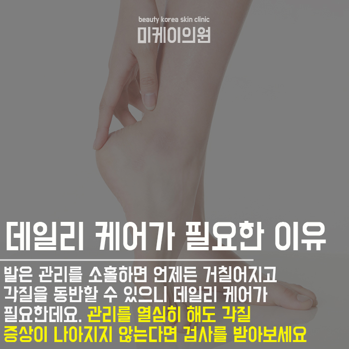 발뒤꿈치관리법 홈케어가 어렵다면 관련 이미지 6