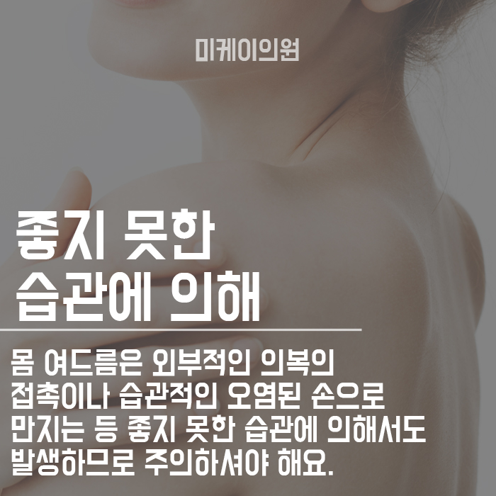 등,가슴 여드름 원인은? 관련 이미지 4