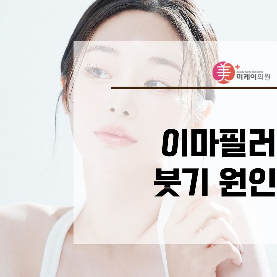What Causes Swelling After Forehead Filler and How to Reduce It image 1