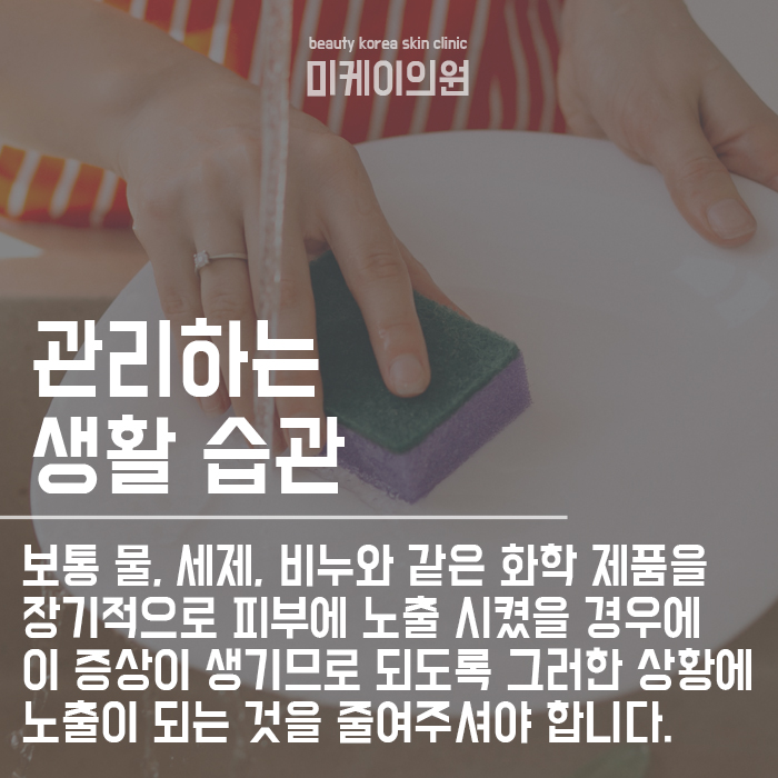 주부습진 관리법 및 예방 방법 무엇이 있을까? 관련 이미지 2