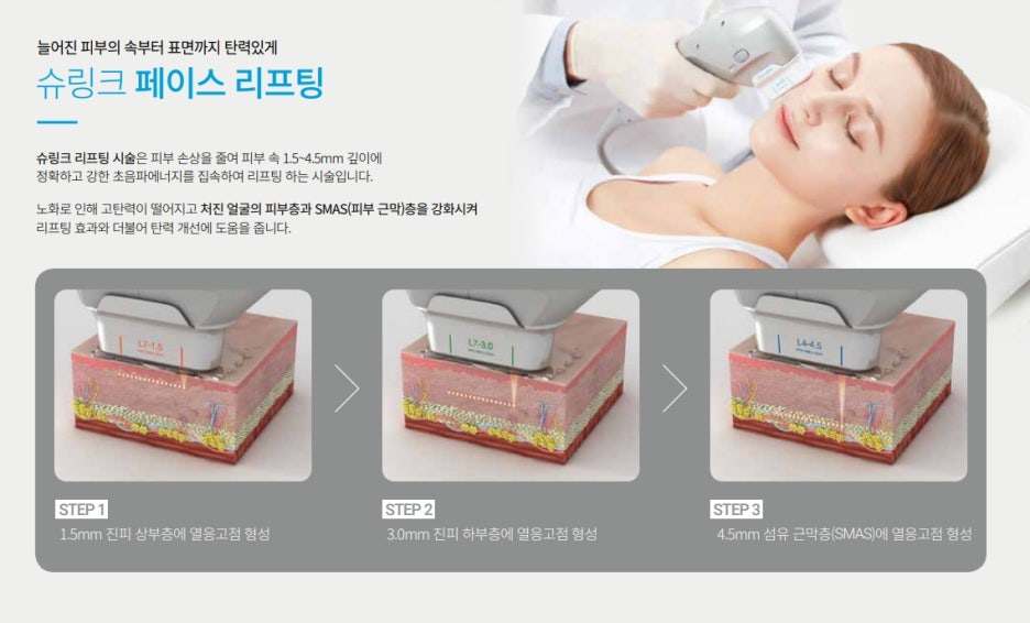 강남v라인슈링크300샷 부위별로 고민 해결! 관련 이미지 5