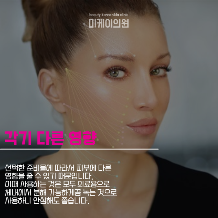 실리프팅 종류 내게 맞게 골라요 관련 이미지 4