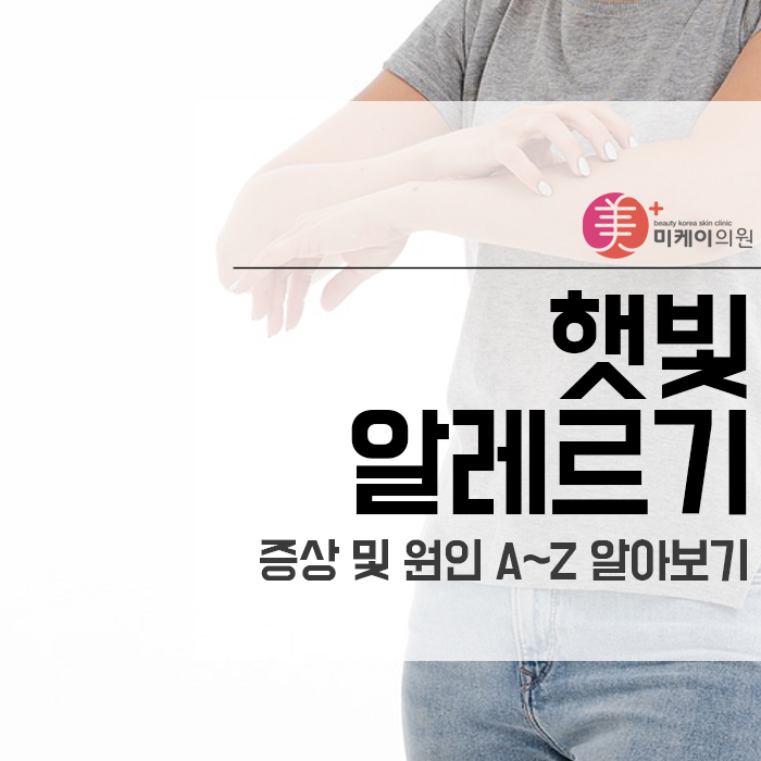 햇빛 알레르기 증상 및 원인 A~Z 알아보기 관련 이미지 1