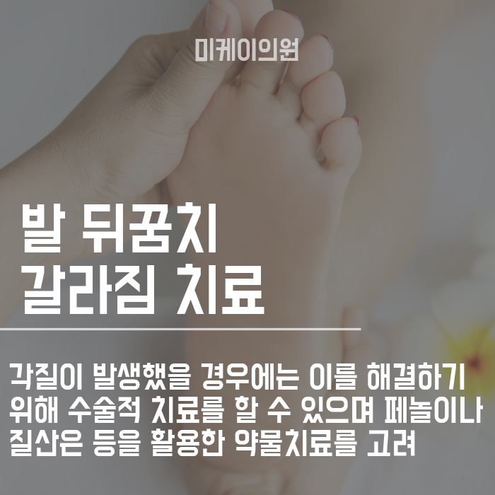 발뒤꿈치 갈라짐 원인 파악하고 해결해봐요! 관련 이미지 3