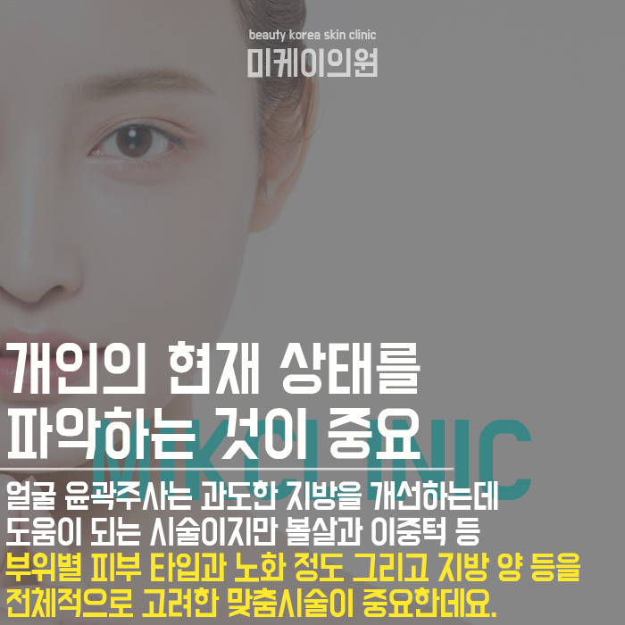 강남윤곽관리 무너진 페이스라인을 개선해요 관련 이미지 3