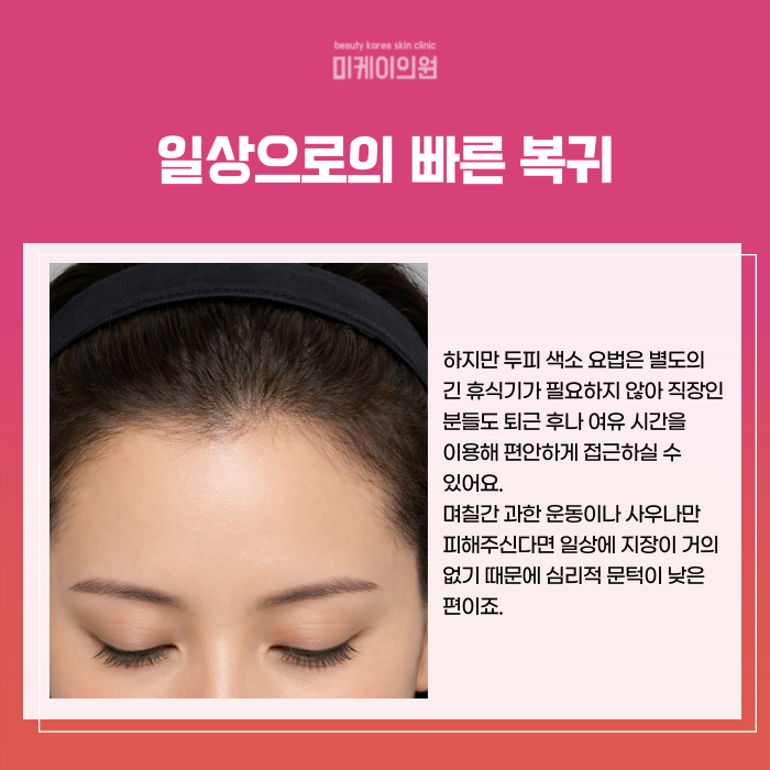 Gangnam Station, Seocho-gu SMP: Natural Hairline and Density image 5