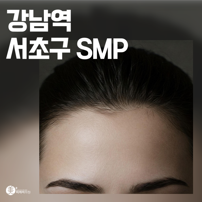 Gangnam Station, Seocho-gu SMP: Natural Hairline and Density image 1