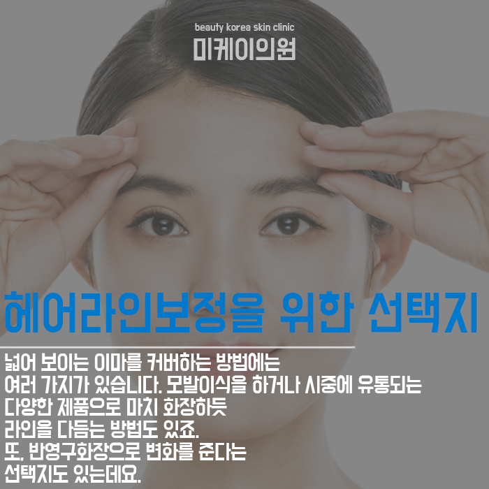 헤어라인보정 내 것 같은 자연스러움은 관련 이미지 2