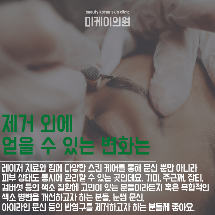 강남문신제거 후회되는 문신 지워요 관련 이미지 4
