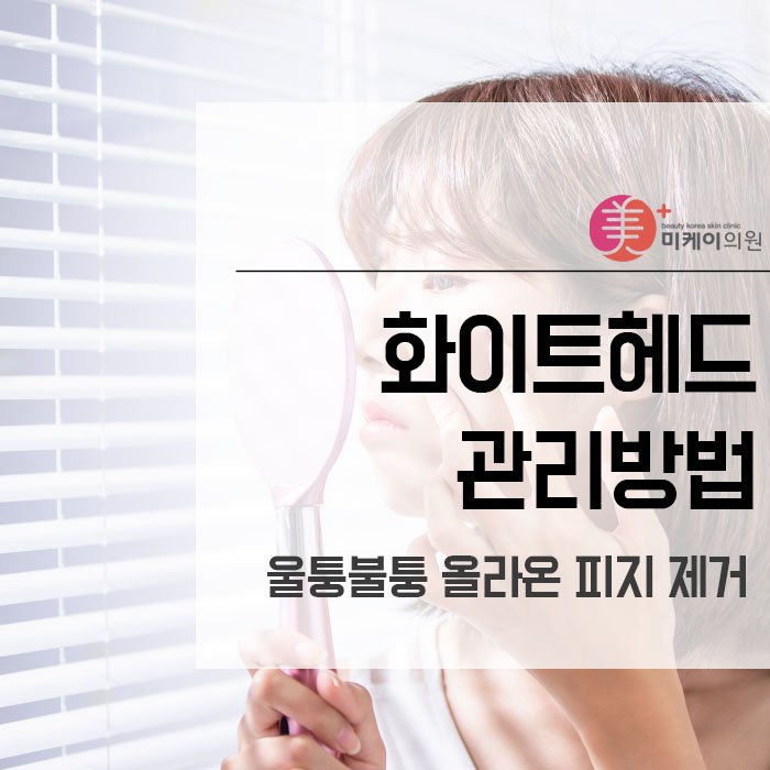 화이트헤드울퉁불퉁 올라온 피지 제거 방법은 관련 이미지 1