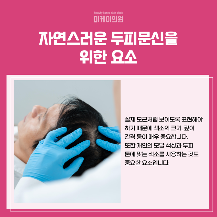 서초 두피문신 잘하는곳 티 안나게 관련 이미지 4