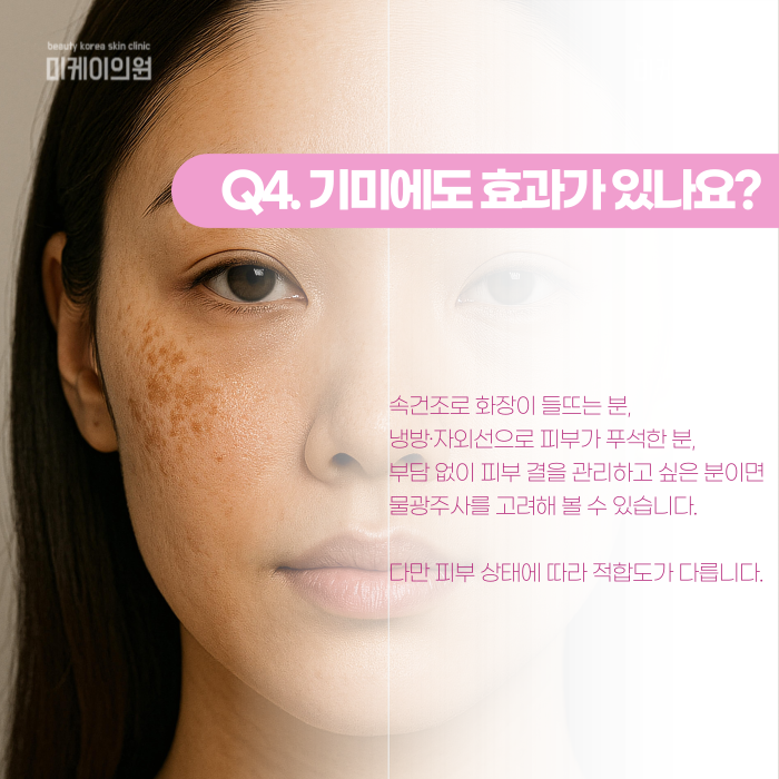 강남 레이저토닝, 한 번에 안 없어지는 이유는? 관련 이미지 5