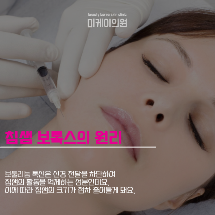 강남역 침샘보톡스 턱선 콤플렉스 해소 관련 이미지 3