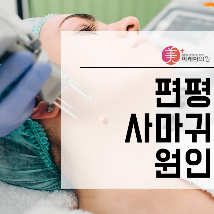 편평사마귀원인 개인에 따라 다를 수 있어 관련 이미지 1