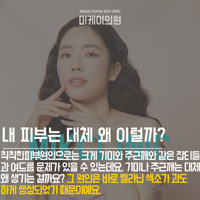 칙칙한피부원인 내 피부톤이 어두운 이유 관련 이미지 2