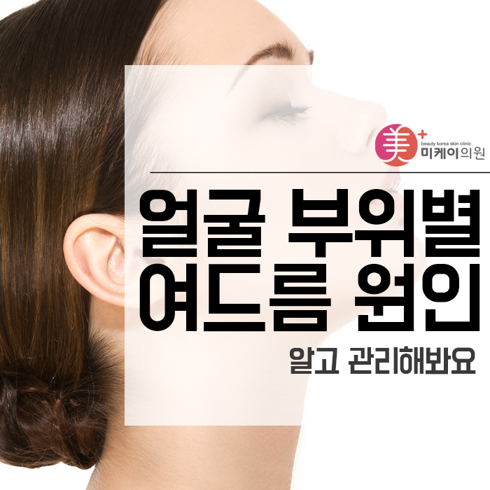얼굴 부위별 여드름 원인 알고 관리해봐요 관련 이미지 1