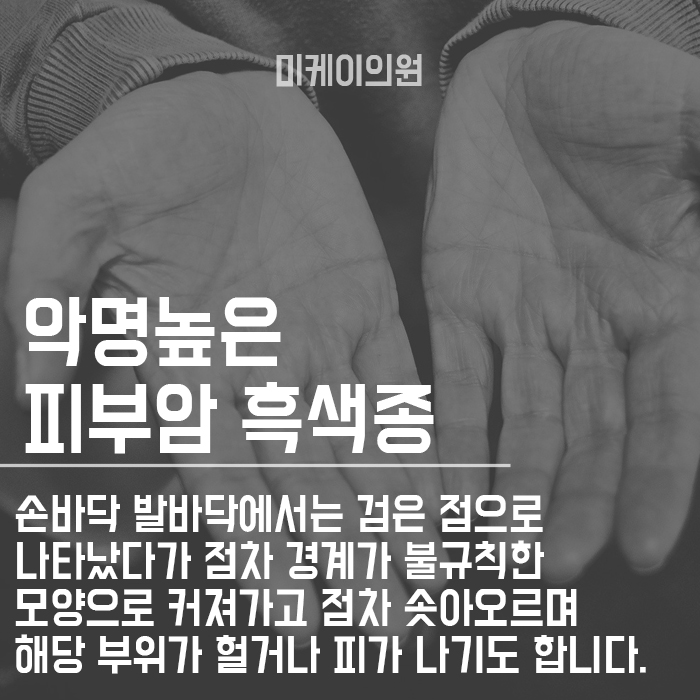 피부암초기증상 잘 읽어보고 초기에 대처해요 관련 이미지 4