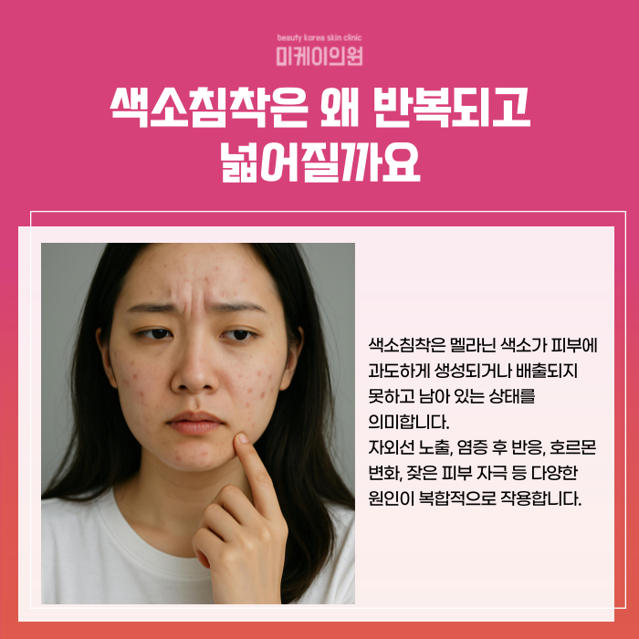 강남 일요일 피부과 색소침착 관리의 이해 관련 이미지 2