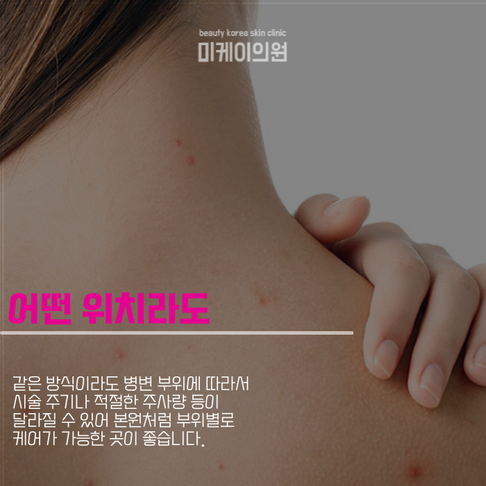 강남여드름피부과 마음의 짐을 덜려면 관련 이미지 4