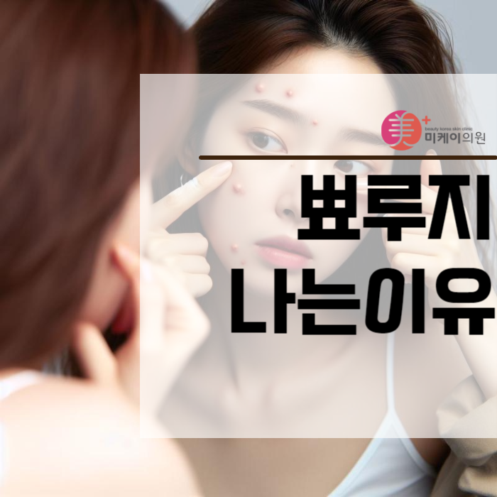 뾰루지나는이유 및 제거 방법 관련 이미지 1