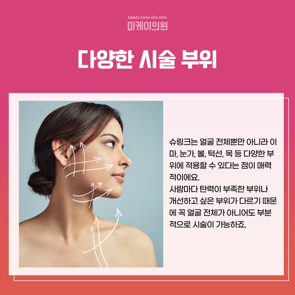 강남역 슈링크 가격 꼼꼼하게 확인해야 관련 이미지 3