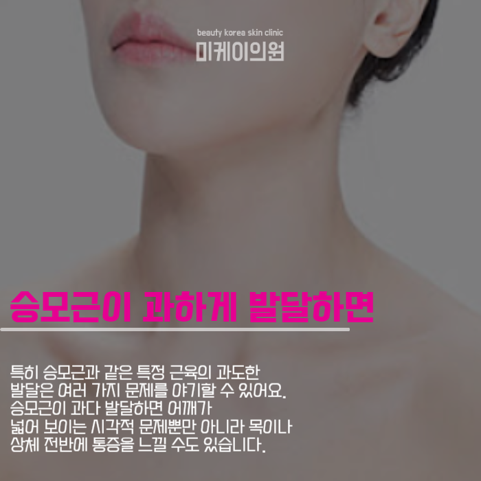 승모근보톡스주기 어느 정도가 적당할까? 관련 이미지 2