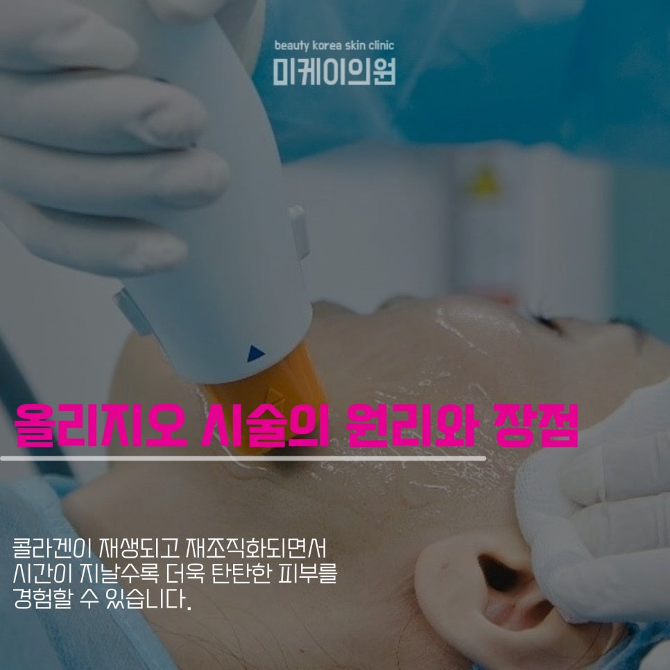 Understanding When Oligio Takes Effect and Managing Skin Elasticity image 2