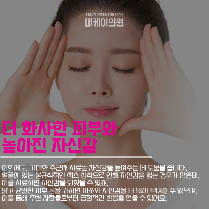 기미주근깨치료로 피부 건강과 자신감을 동시에 관련 이미지 5