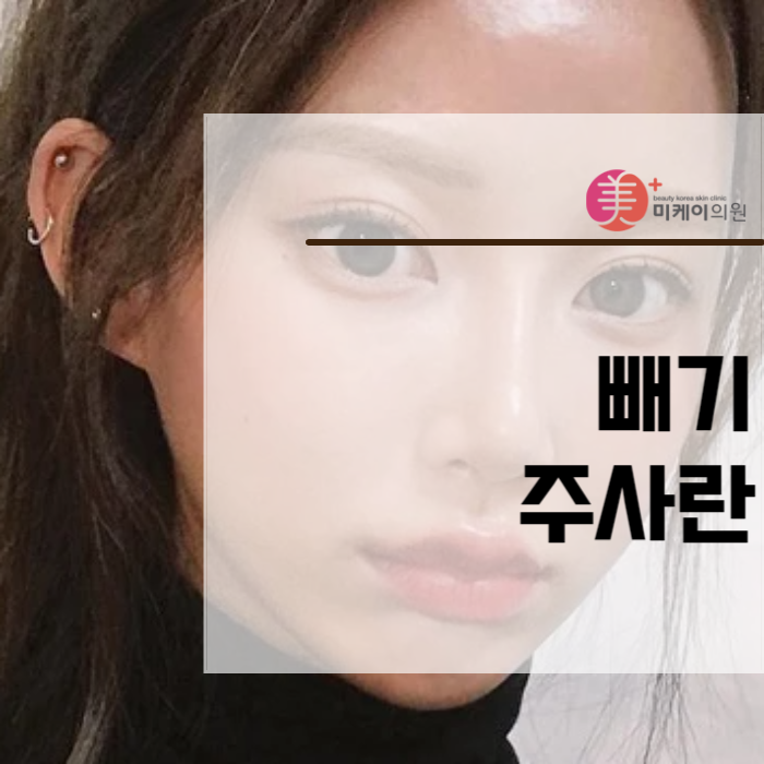 빼기주사 얼굴살 고민일때 관련 이미지 1
