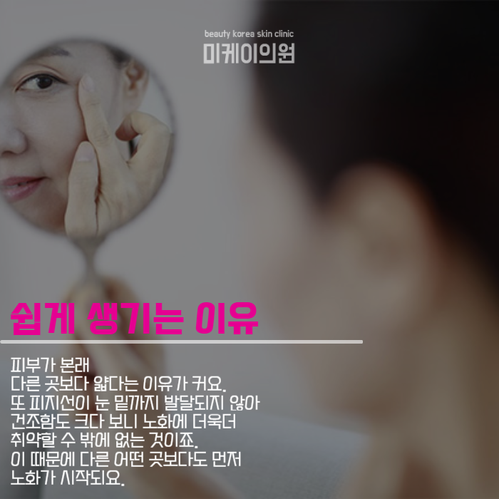 눈가주름시술 아이슈링크로 해결하세요 관련 이미지 2