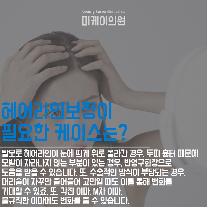 헤어라인보정 내 것 같은 자연스러움은 관련 이미지 4