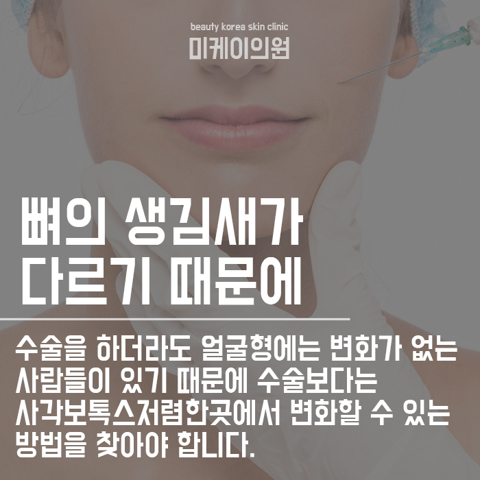 강남역 사각보톡스저렴한곳 알아볼까요? 관련 이미지 2