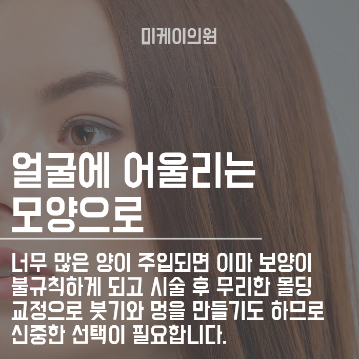 강남역근처피부과 필러　자연스러운 이마 볼륨 관련 이미지 6