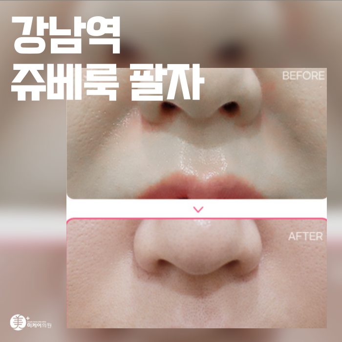 강남역 쥬베룩 팔자 자연스럽게 채우는곳 관련 이미지 1