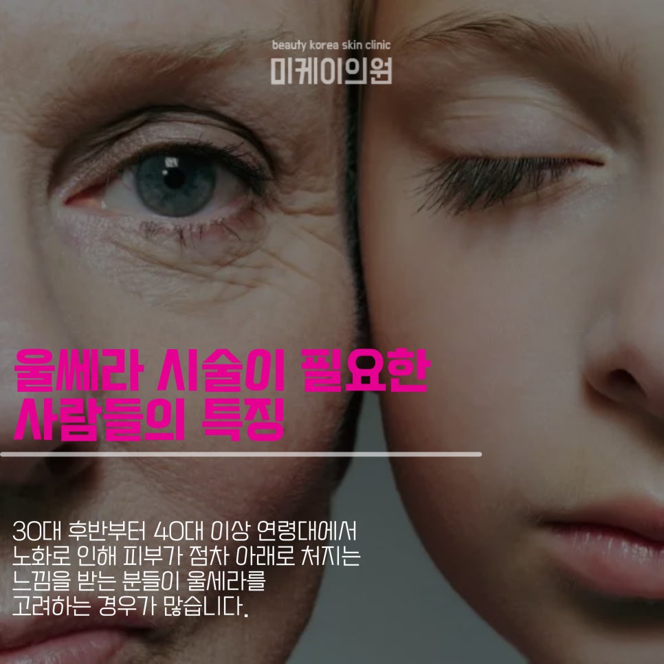 울쎄라 부작용 볼패임 미리 알아두기 관련 이미지 2