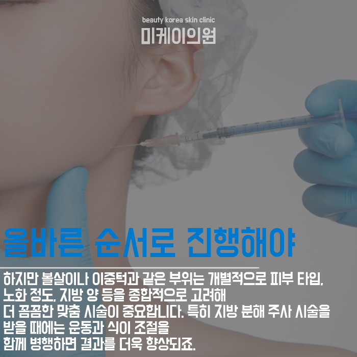 강남윤곽주사 어떤 점을 고려해야 할까 관련 이미지 4